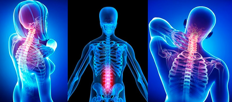 Chiropractic and spine rehabilitation anatomical reference